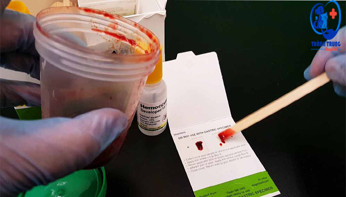 Kiểm tra máu khi xét nghiệm phân