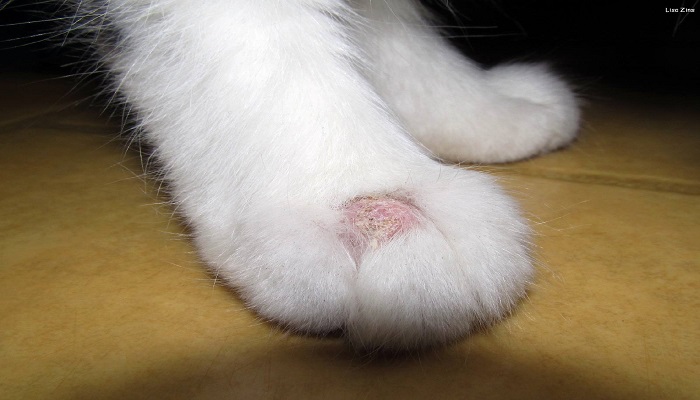 Bệnh nấm mèo ở chân