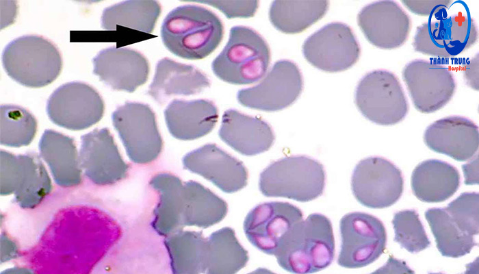 Hình ảnh ký sinh trùng Babesia ở chó